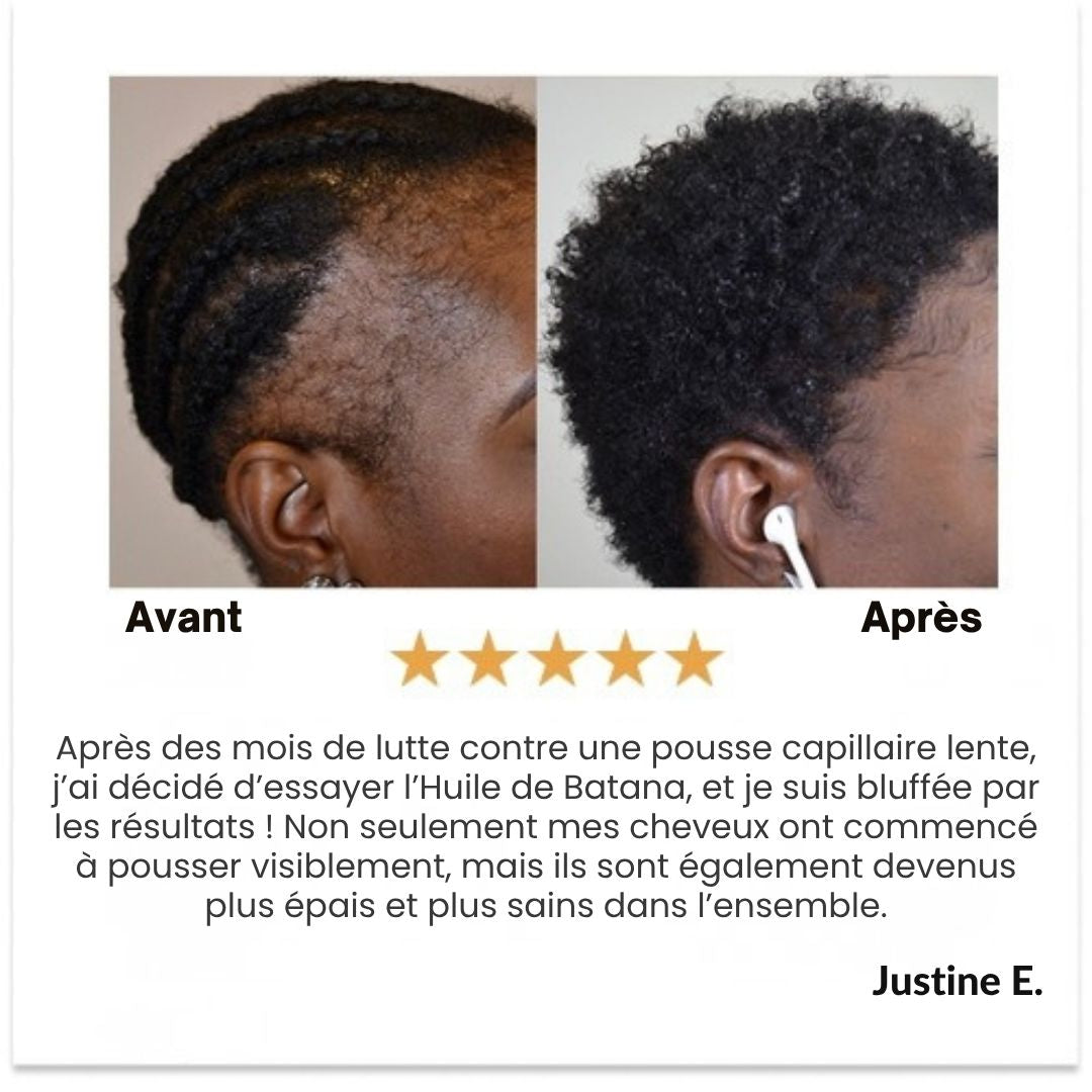 Huile de croissance des cheveux naturels Batana