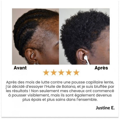 Huile de croissance des cheveux naturels Batana