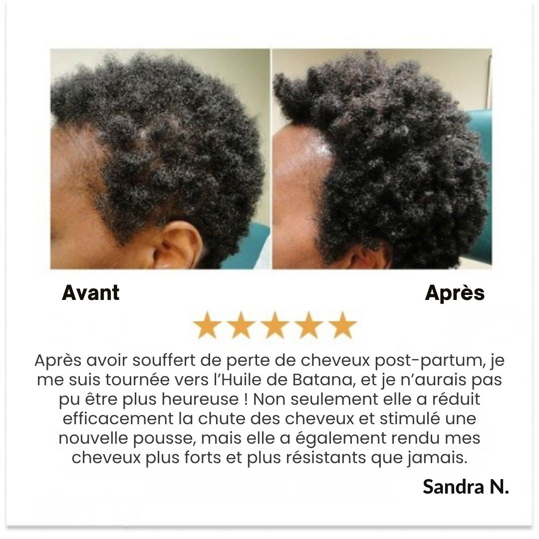 Huile de croissance des cheveux naturels Batana