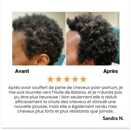 Huile de croissance des cheveux naturels Batana