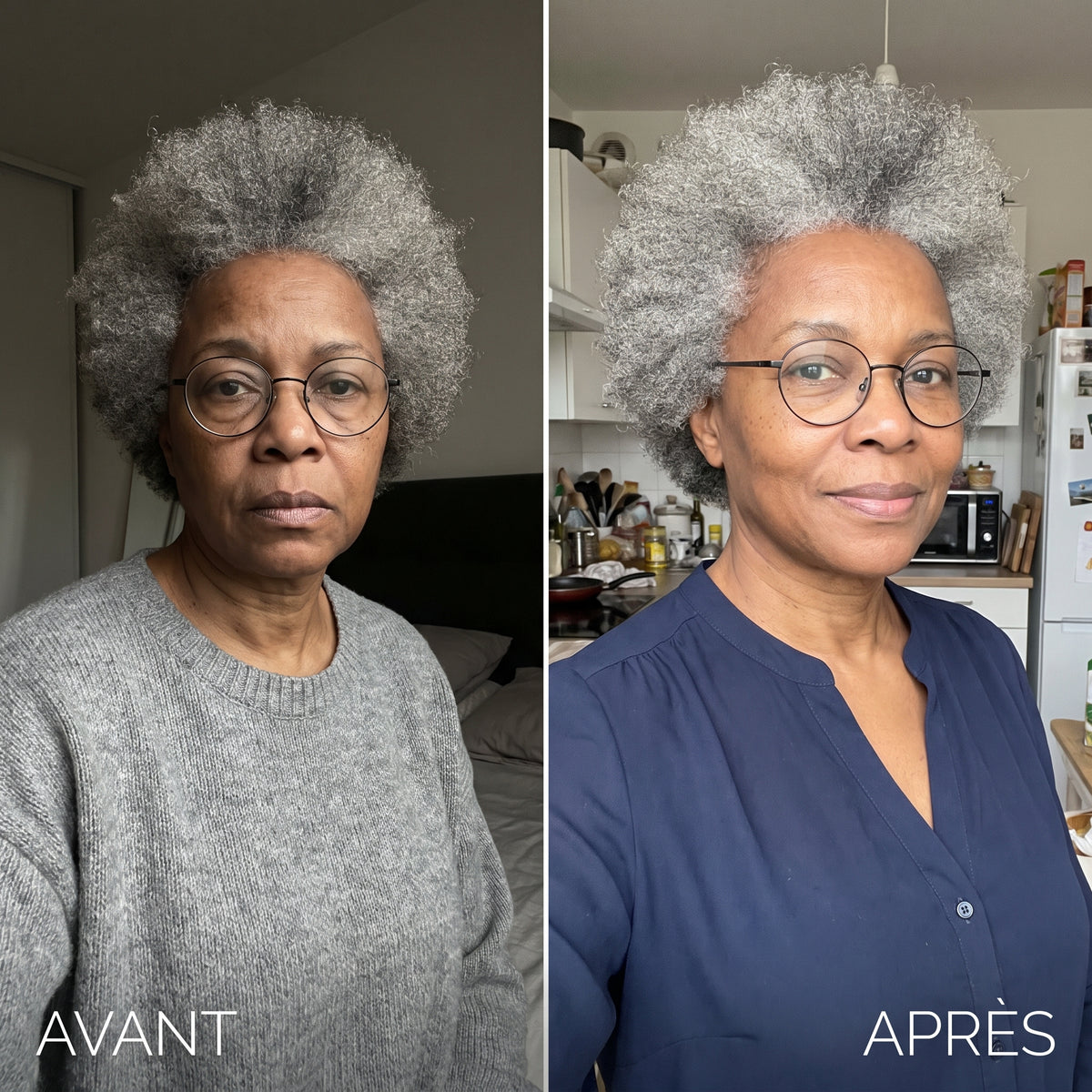 Orvane - Sérum liftant raffermit visiblement votre peau dès la première application -