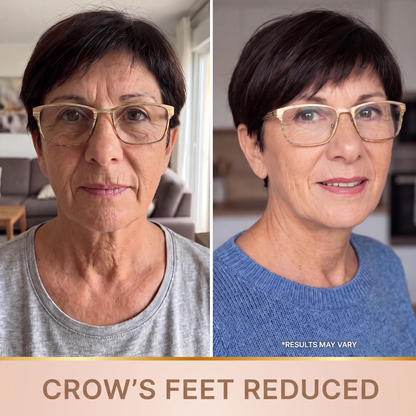 Orvane — Softened crow's feet