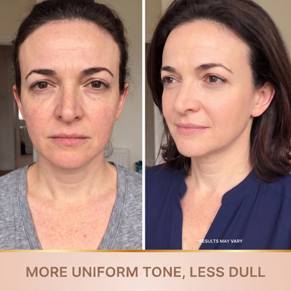 Orvane — More even tone, less dullness