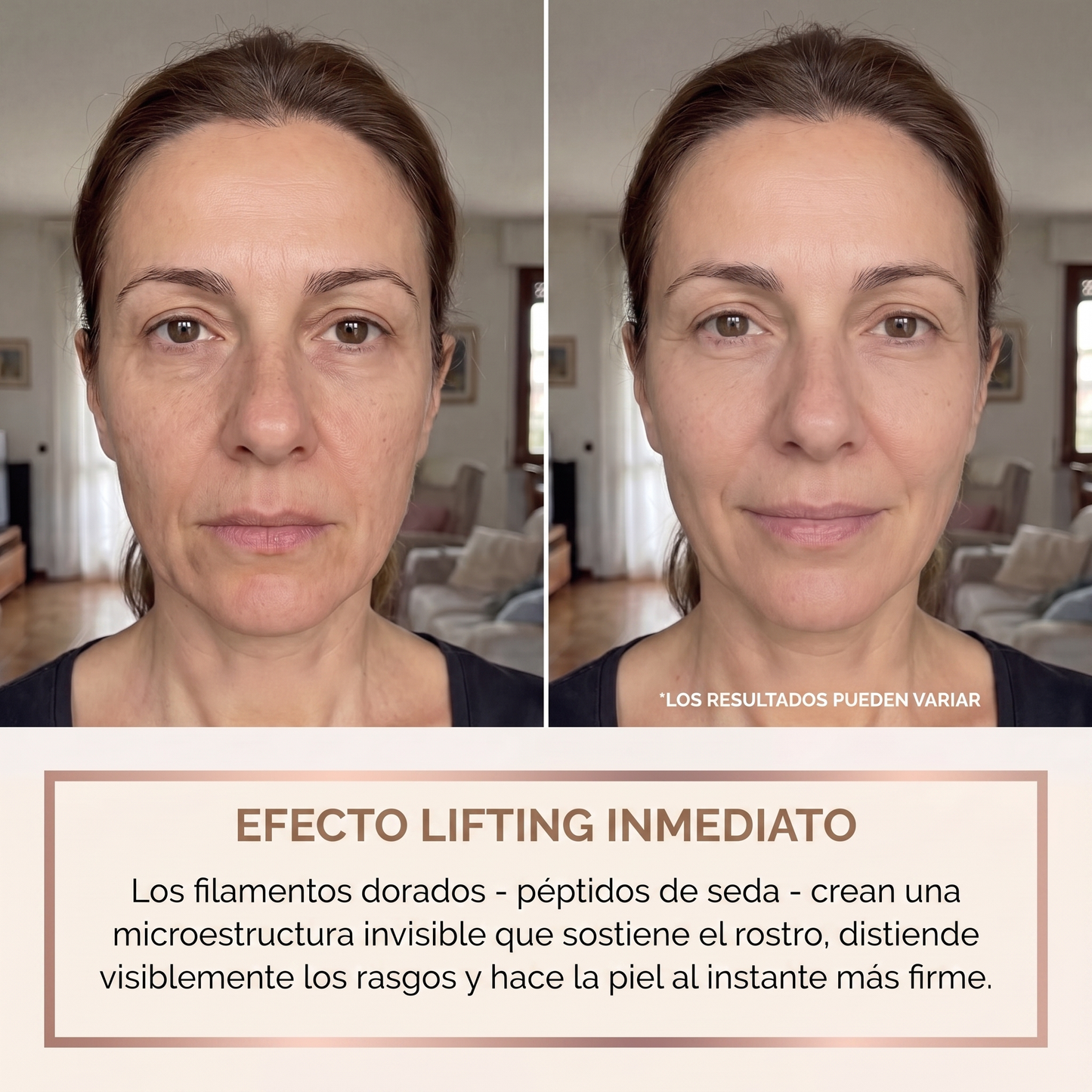 Orvane — Efecto lifting inmediato