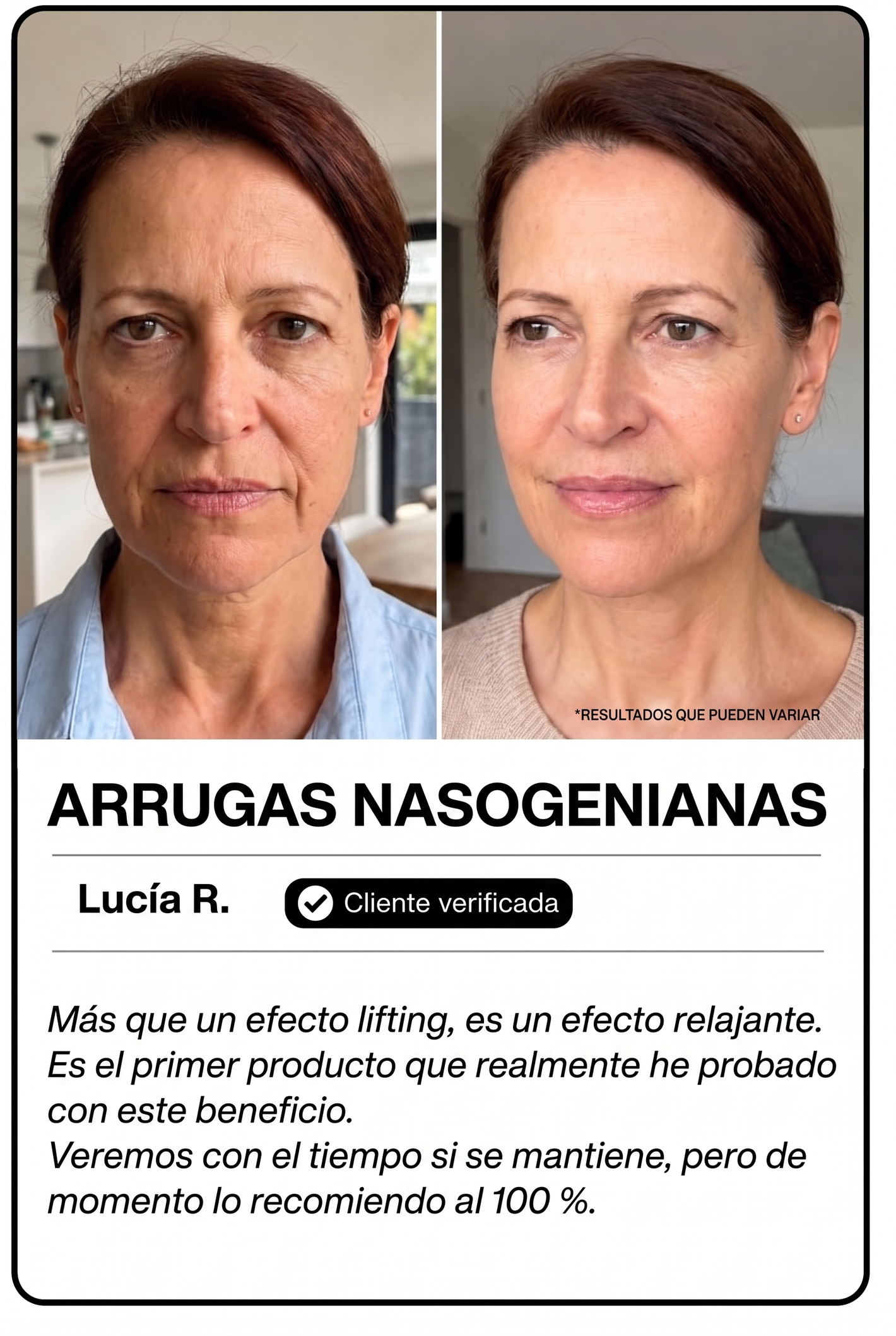 Orvane — Testimonio arrugas nasogenianas