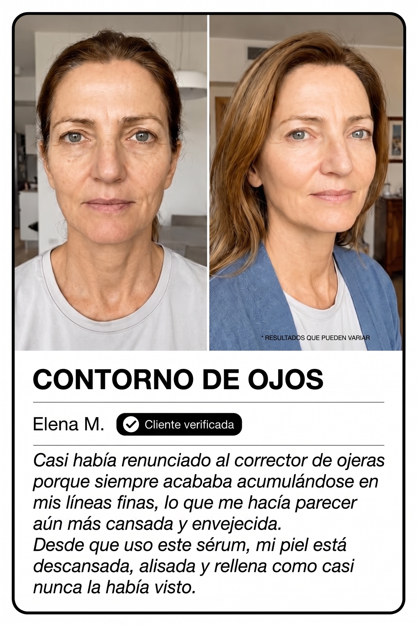 Orvane — Testimonio contorno de ojos